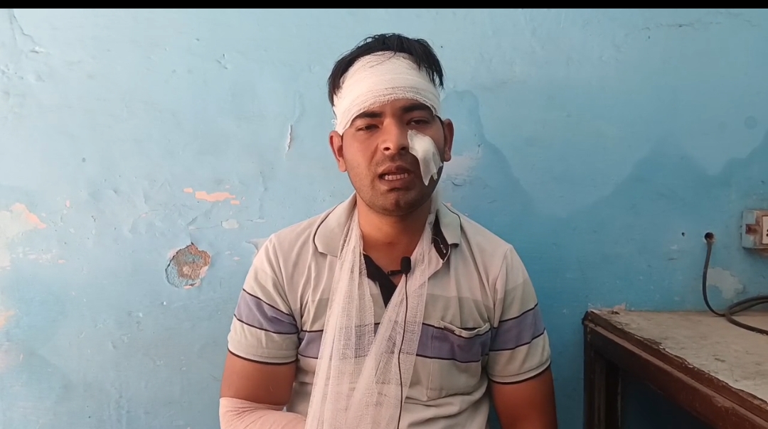 फर्जी हाजिरी का विरोध करने पर नगर पालिका कर्मी से मारपीट, बाबू आदित्य कुमार लहूलुहान